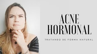 ACNE HORMONAL  COMO TRATAR DE FORMA NATURAL [upl. by Riggs]