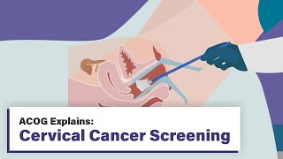 ACOG Explains Cervical Cancer Screening [upl. by Cocks500]