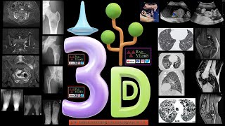 TOP THREE DIFFERENTIAL DIAGNOSIS SET II [upl. by Aronow]