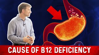 Vitamin B12 Deficiency The most common Cause – Dr Berg [upl. by Coppins]