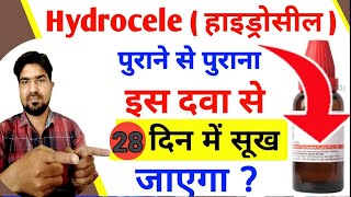 Hydrocele  Homeopathic medicine in Hydrocele  हाइड्रोसिल [upl. by Ahseyk]