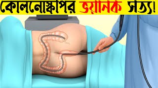 Colonoscopy কিভাবে ও কেন করা হয়  reuploaded [upl. by Aryek744]