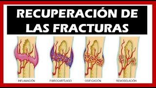 Consolidación de las Fracturas 🦴 Tiempo Fases [upl. by Caraviello239]