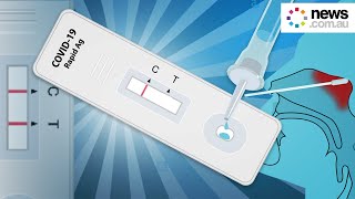 How to take a Rapid COVID Test [upl. by Tonjes]