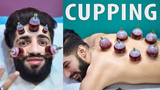 Wet Cupping Therapy \ Hijama for Skin Care  My First Hijama Cupping [upl. by Lerrehs]