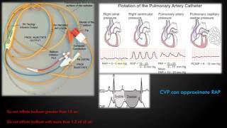 Hemodynamic Monitoring Part 1 [upl. by Tobi]