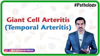 Giant cell arteritis Temporal arteritis Vasculitis Pathology  Usmle Step 1 [upl. by Annas]