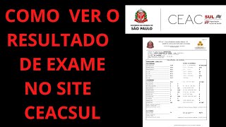 COMO VER O RESULTADO DE EXAME FEITO NO POSTO DE SAÚDE NO SITE CEACSUL [upl. by Castera]