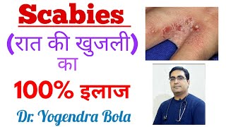 Scabies  ka complete treatment in hindi  scarab scabilice lotion permite 5 vermact 12 mg tab [upl. by Eisserc]