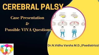 Cerebral palsy case presentation amp viva questions part 1 [upl. by Notsnorb]