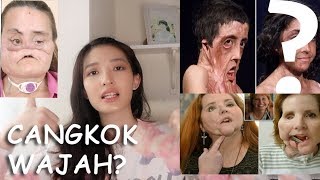 OPERASI PLASTIK CANGKOK WAJAH PALING EKSTRIM DI DUNIA Cindy Thefannie [upl. by Edwina]