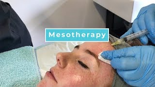 Mesotherapy With Anna [upl. by Yrrat]