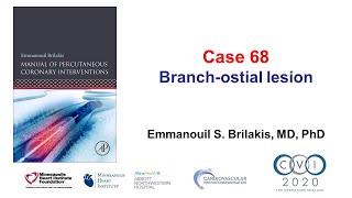 Case 68  PCI Manual  Branch ostial lesion [upl. by Dahle398]