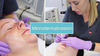 Microdermabrasion  The Laser and Skin Clinic [upl. by Gilligan]