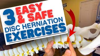 3 EASY amp SAFE L5S1 Disc Herniation Exercises amp L4L5  Dr Marc Dupuis Chiropractor in Sanford ME [upl. by Ydac]