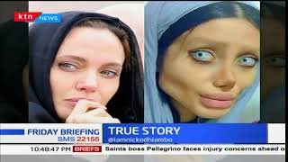 True Story Photo of a 22year old woman from Iran plastic surgery [upl. by Arikahs]