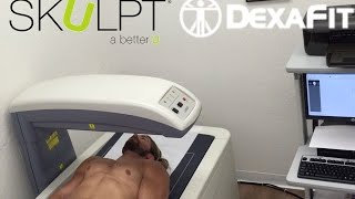 Review Dexa Scan Vs SKulpt Body Fat Analysis [upl. by Airdnat]