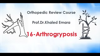 16Arthrogryposis prof Dr Khaled Emara تشوه الاطراف مرض ارثروجرايبوسس  أد خالد عمارة [upl. by Latsyrhk]