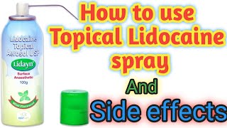 How to use Topical Lidocaine spray And its side effectsDental Bharat [upl. by Cohn732]