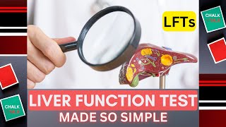 LIVER FUNCTION TEST LFTs [upl. by Salamanca]