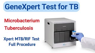 GeneXpert Test for TB  Full Procedure  Xpert MTBRIF Test  Creative Zone Plus [upl. by Niffirg226]