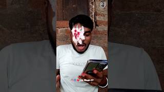 eyes damaged 👁️👁️😱magic tricks lifehacks viral trending shortfeed shorts [upl. by Maidel828]