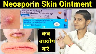 Neomycin and polymyxin b sulfates and bacitracin zinc ointment usp in hindi  neosporin ointment [upl. by Vinni]