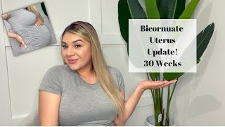 Bicornuate Uterus Update  30 Weeks Pregnant  3rd Trimester [upl. by Yssim]