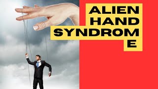 Alien Hand Syndrome  जब आपका हाथ आपकी मर्ज़ी के ख़िलाफ़ चले [upl. by Diane]