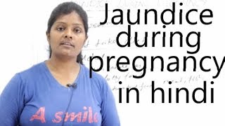 Jaundice During Pregnancy Lecture in Hindi  Causes Signs amp Symptoms  Complication  Management [upl. by Weider]