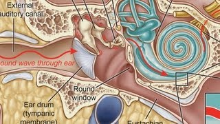 What Is a Middle Ear Infection  Ear Problems [upl. by Edee]