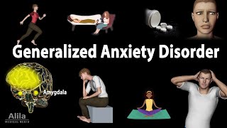 Generalized Anxiety Disorder GAD Animation [upl. by Aeynod792]