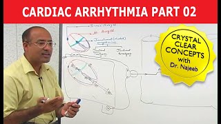 Cardiac Arrhythmia  Part 23 [upl. by Eirehs156]