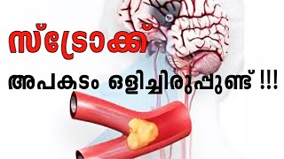 സ്ട്രോക്ക് വന്നാൽ ശരീരം കാണിക്കുന്ന ചില ലക്ഷണങ്ങൾ  DOCTOR INTERVIEW  STROCK [upl. by Oad569]