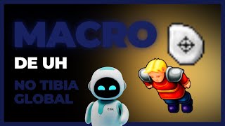 MACRO UH  TIBIA GLOBAL  MSRP  BOT TIBIA GLOBAL [upl. by Aleakim]