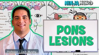 Pons Lesions [upl. by Airual]