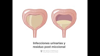 Infecciones urinarias y residuo post miccional [upl. by Llemert885]