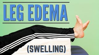 Top 7 Exercises for Leg Edema or Swelling Program or Protocol for Edema [upl. by Santa]