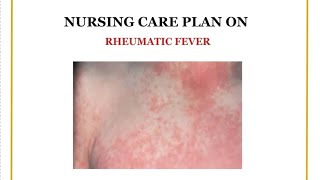 Nursing care plan on Rheumatic fever Ncp on Pediatric Rheumatic fever Nursing assignment of Pedia [upl. by Braunstein]