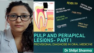 Pulp and periapical lesions  Part I in Hindi। Chairside Diagnosis [upl. by Hymen878]