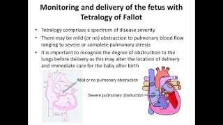 Tetralogy of Fallot Prenatal Diagnosis and Management  Dr Helena Gardiner [upl. by Flanna]