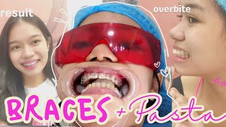 I GOT BRACES vlog at Denta Care Philippines  love jella ♡ [upl. by Laurence]