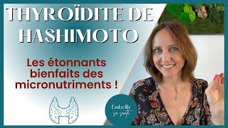 Hypothyroïdie d’Hashimoto régime alimentaire et solutions naturelles [upl. by Ralf444]