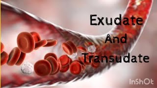 Exudate and Transudate  Basic Pathology [upl. by Nirehtak958]