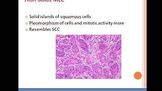 Mucoepidermoid Carcinoma 22024 [upl. by Arvin]