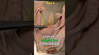 Understanding Fibroids Symptoms and Treatments Part 2 health healthyhabits fibroid shorts fyp [upl. by Rabassa]