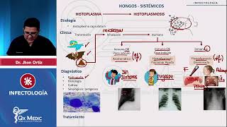 Hongos Sistémicos Histoplasma Paracoccidioides mp4 [upl. by Arrat]