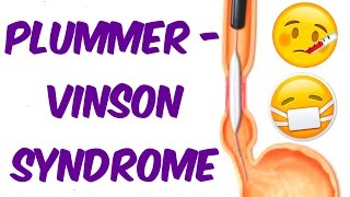 Plummer Vinson Syndrome in 6 mins [upl. by Dasi]