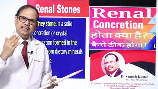 Renal concretion kidney me balu ka dana DrProfSantosh Kumar PGI [upl. by Tala]