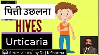 पित्ती उछलने 🥵के कारणलक्षण और इलाज🧐 hives urticaria allergy skin how what reasons treat [upl. by Eednar]